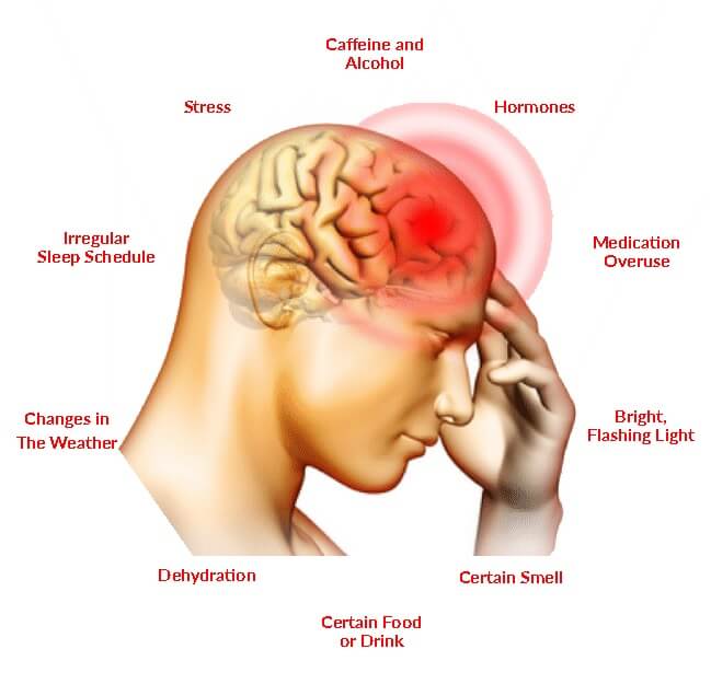 Migraine Trigger Factors
