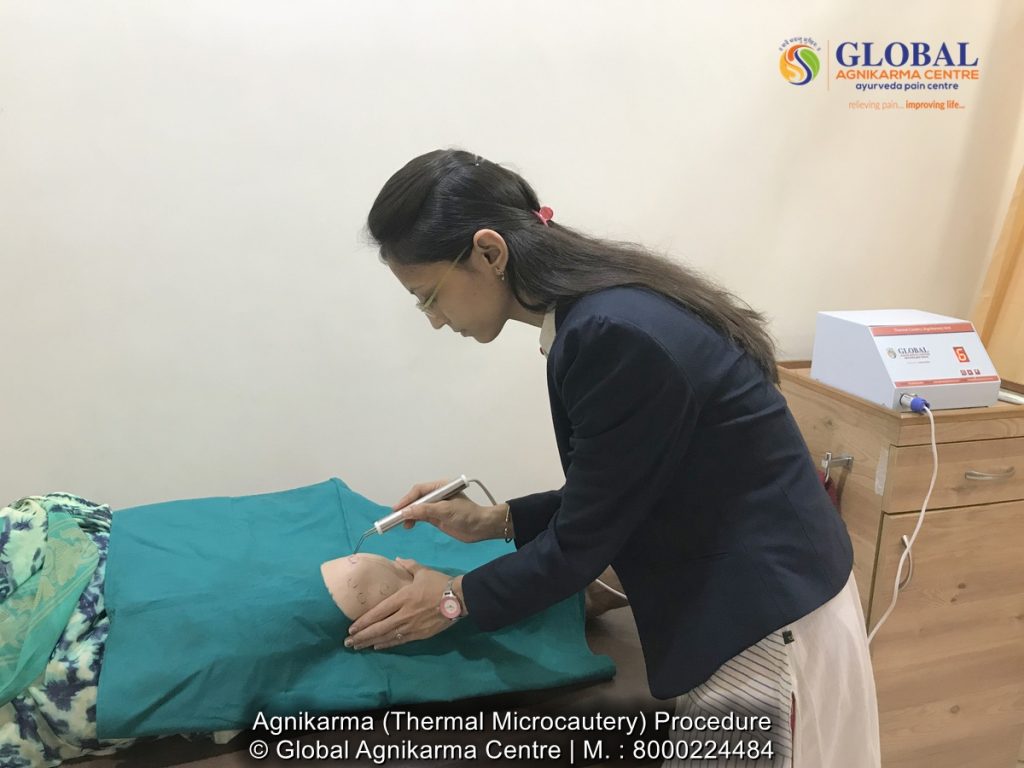 Agnikarma (Thermal Microcautery) Procedure