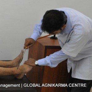 Global Agnikarma Centre_Ayurveda_Agnikarma_Shalaka_Ayurveda Pain Management